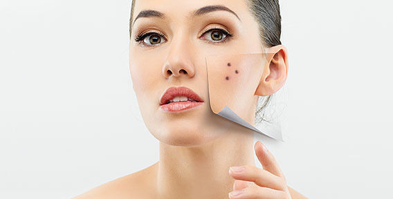 Видалення новоутворень